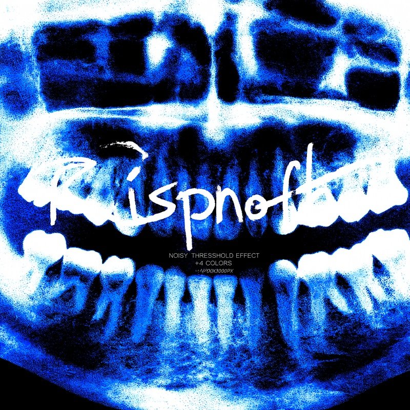 Dental X Ray With Overlaid Text Dental X Ray Risograph